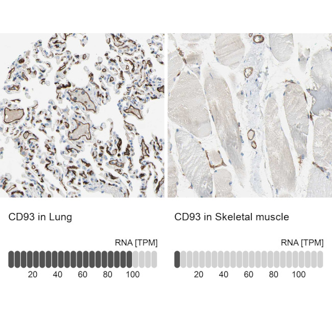 CD93 Antibody in Immunohistochemistry (IHC)