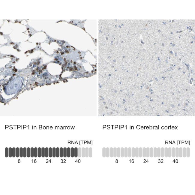 PSTPIP1 Antibody in Immunohistochemistry (IHC)