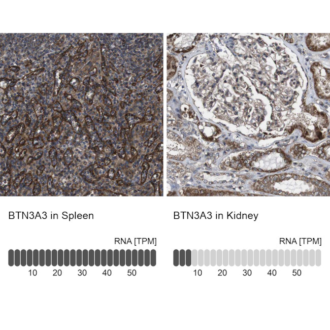 BTN3A3 Antibody in Immunohistochemistry (IHC)