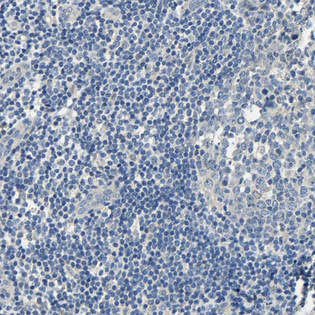 Centaurin alpha-1 Antibody in Immunohistochemistry (IHC)