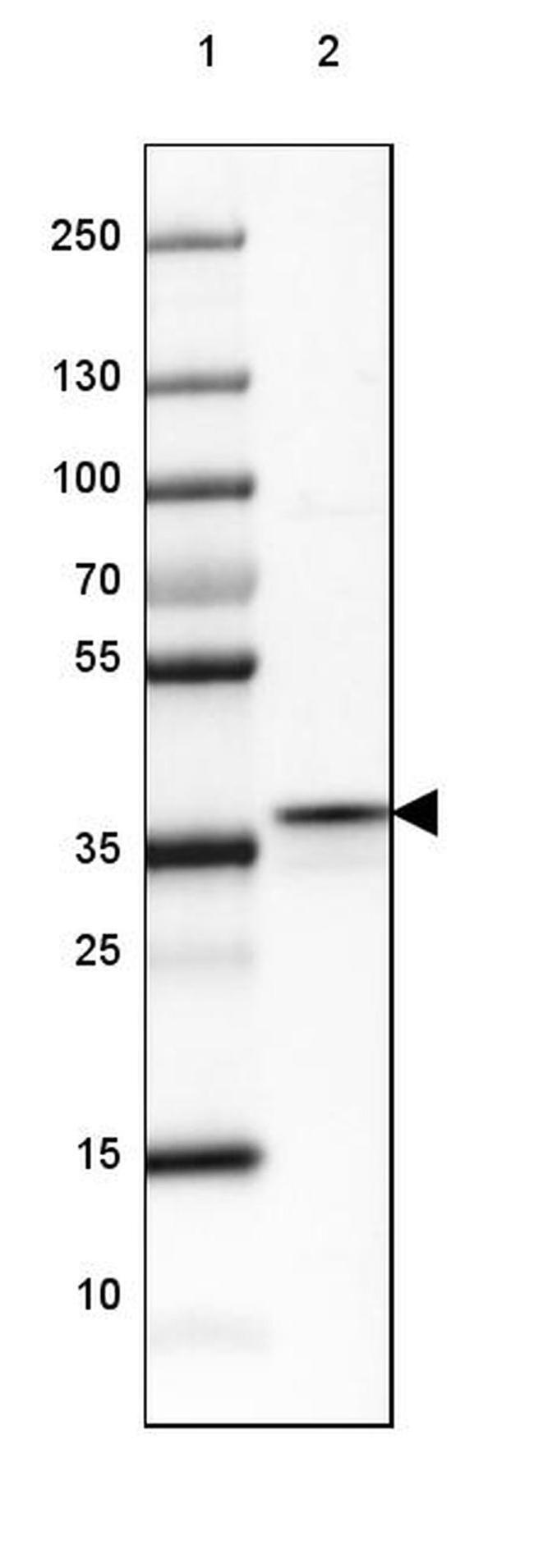 FBP1/FBP2 Antibody in Western Blot (WB)
