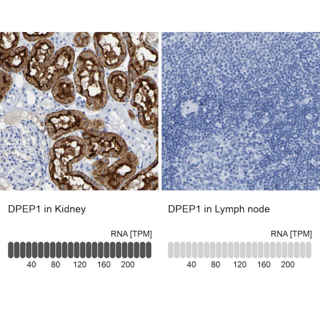 DPEP1 Antibody in Immunohistochemistry (IHC)