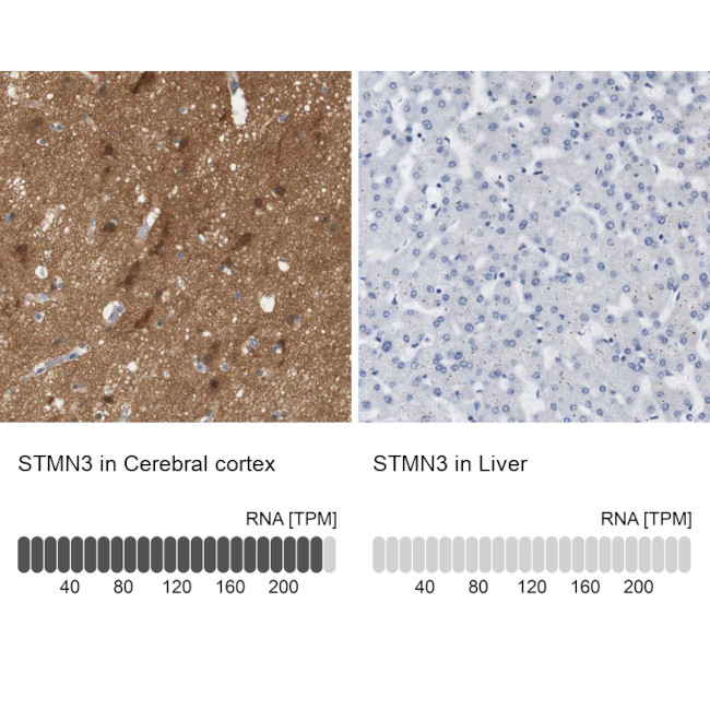 STMN3 Antibody in Immunohistochemistry (IHC)