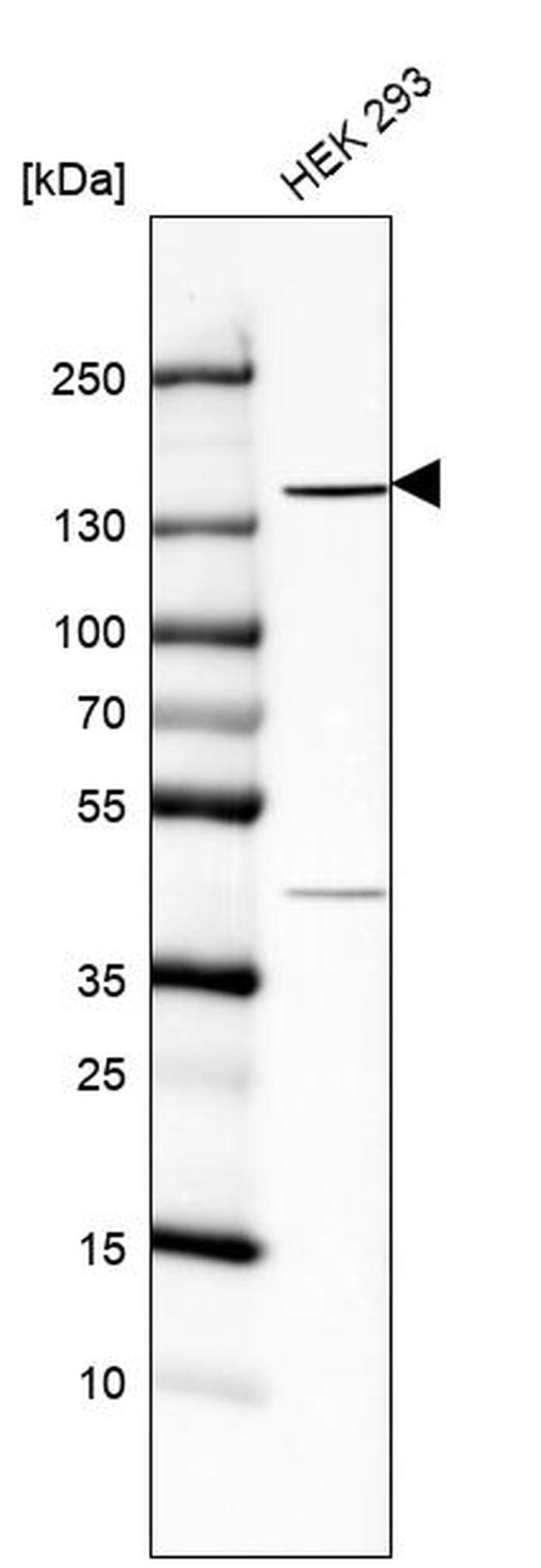 C6orf170 Antibody in Western Blot (WB)