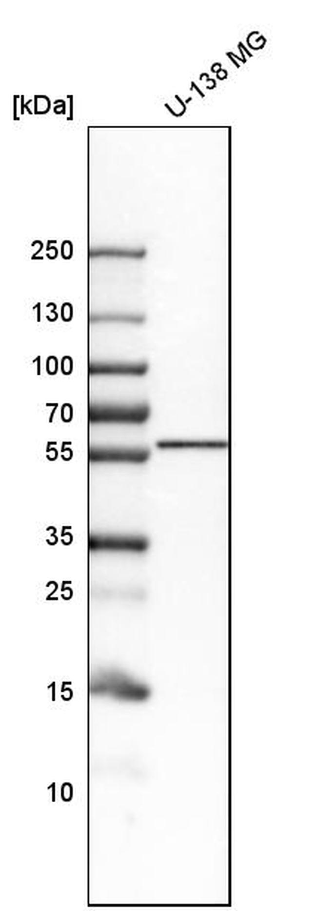 LNP Antibody in Western Blot (WB)