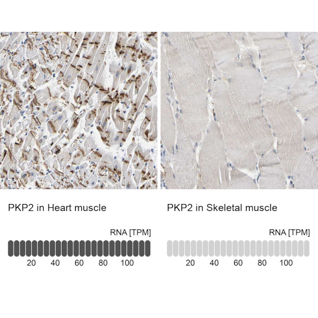 PKP2 Antibody in Immunohistochemistry (IHC)