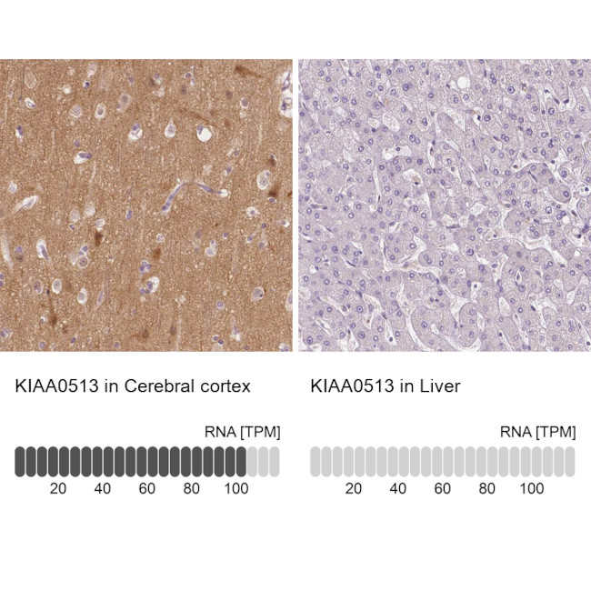 KIAA0513 Antibody in Immunohistochemistry (IHC)