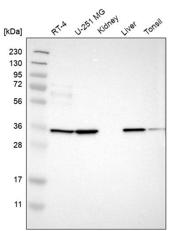 TMEM51 Antibody in Western Blot (WB)