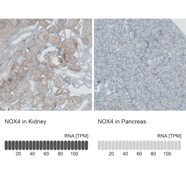 NOX4 Antibody in Immunohistochemistry (IHC)