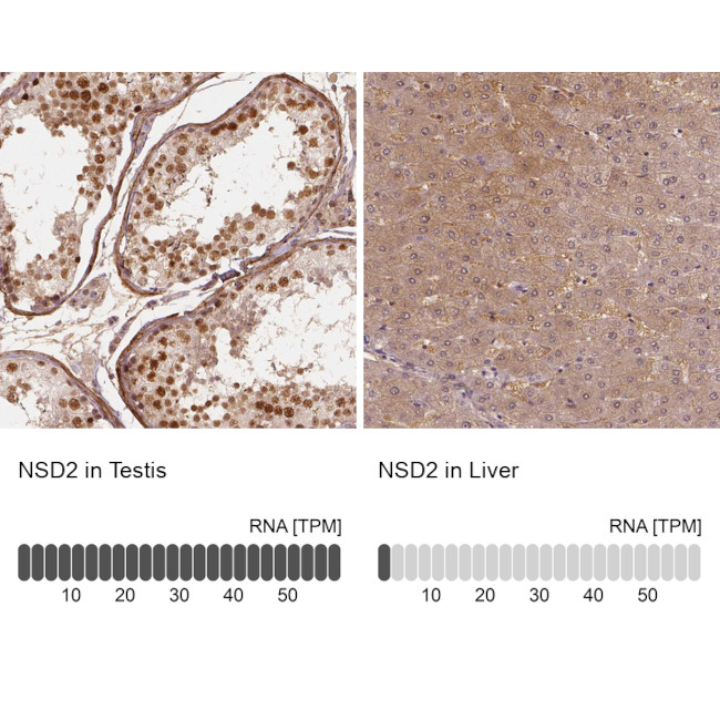 NSD2 Antibody in Immunohistochemistry (IHC)