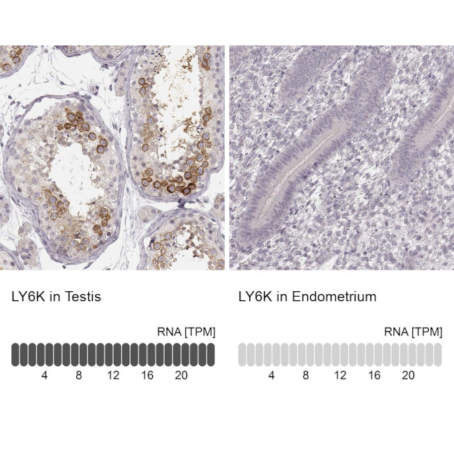 LY6K Antibody in Immunohistochemistry (IHC)