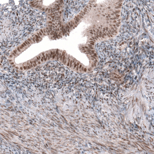 TNRC6A Antibody in Immunohistochemistry (IHC)