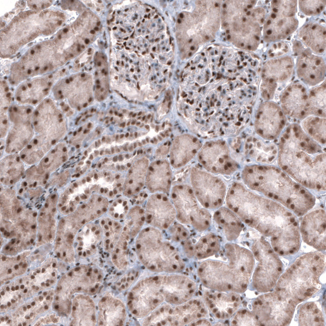 TNRC6A Antibody in Immunohistochemistry (IHC)