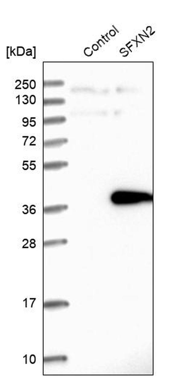 SFXN2 Antibody in Western Blot (WB)