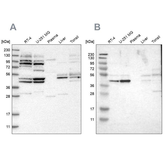 WDR53 Antibody in Western Blot (WB)