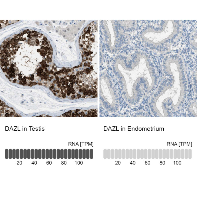 DAZL Antibody in Immunohistochemistry (IHC)