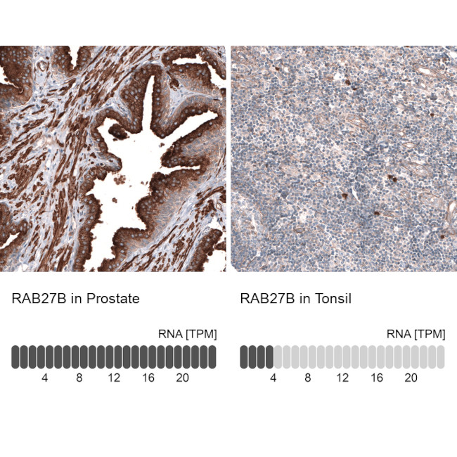 RAB27B Antibody in Immunohistochemistry (IHC)
