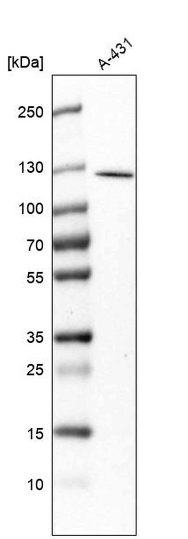 RASAL2 Antibody in Western Blot (WB)