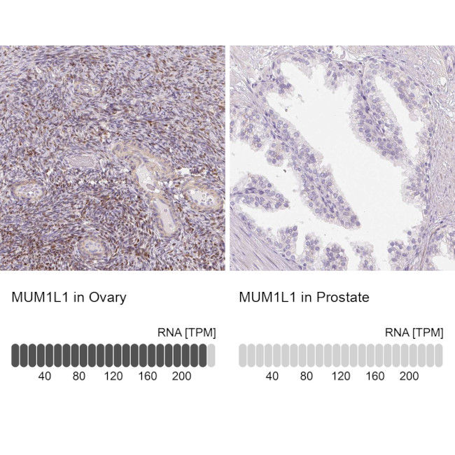 MUM1L1 Antibody in Immunohistochemistry (IHC)