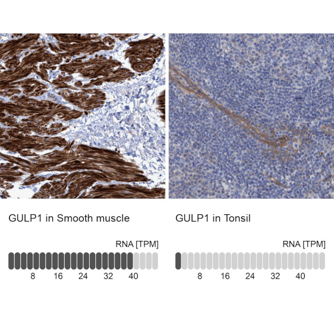 GULP1 Antibody in Immunohistochemistry (IHC)