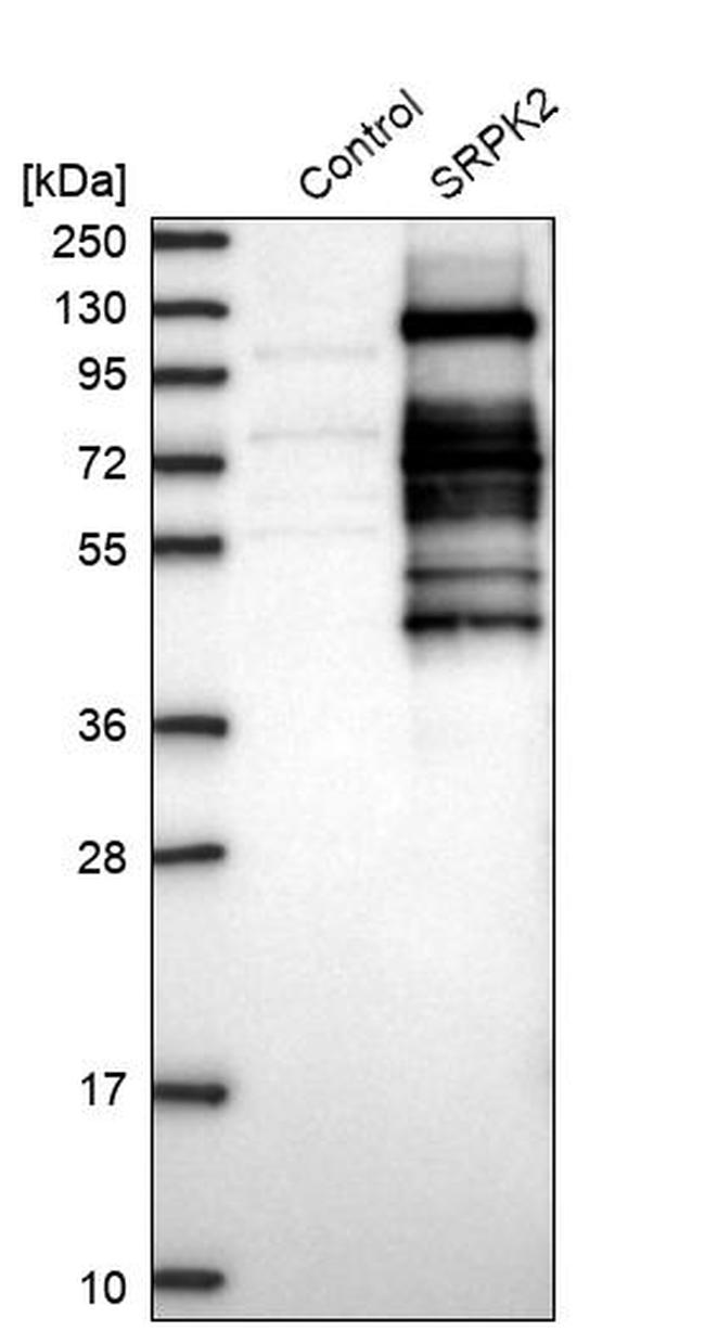 SRPK2 Antibody in Western Blot (WB)