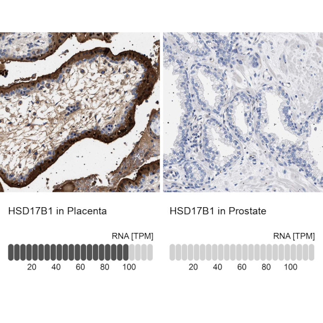 HSD17B1 Antibody in Immunohistochemistry (IHC)