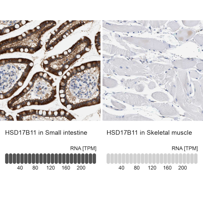 HSD17B11 Antibody in Immunohistochemistry (IHC)