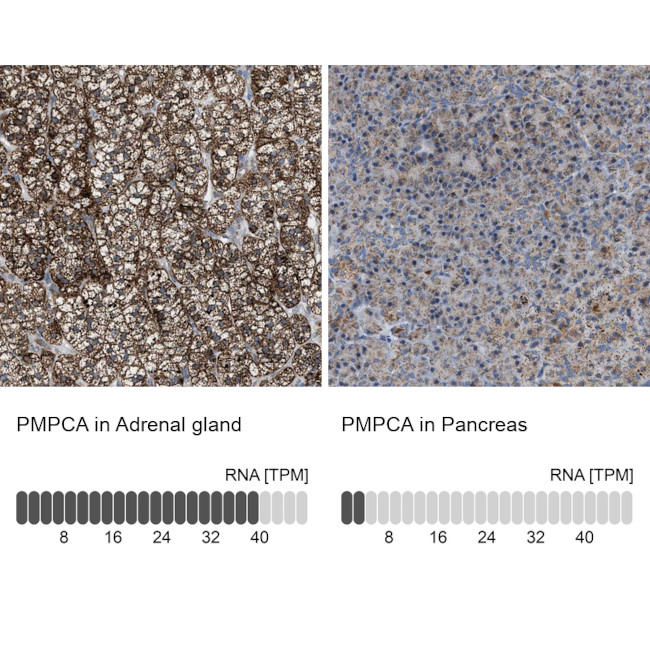 PMPCA Antibody in Immunohistochemistry (IHC)