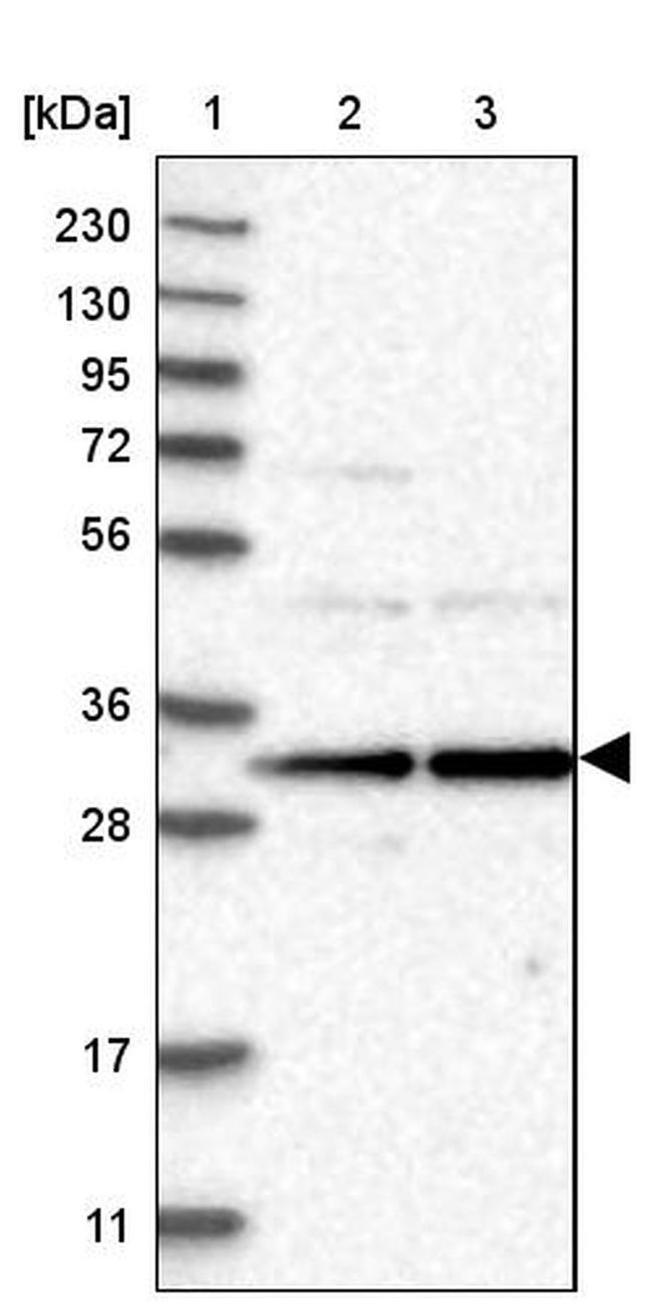 RRP4 Antibody in Western Blot (WB)