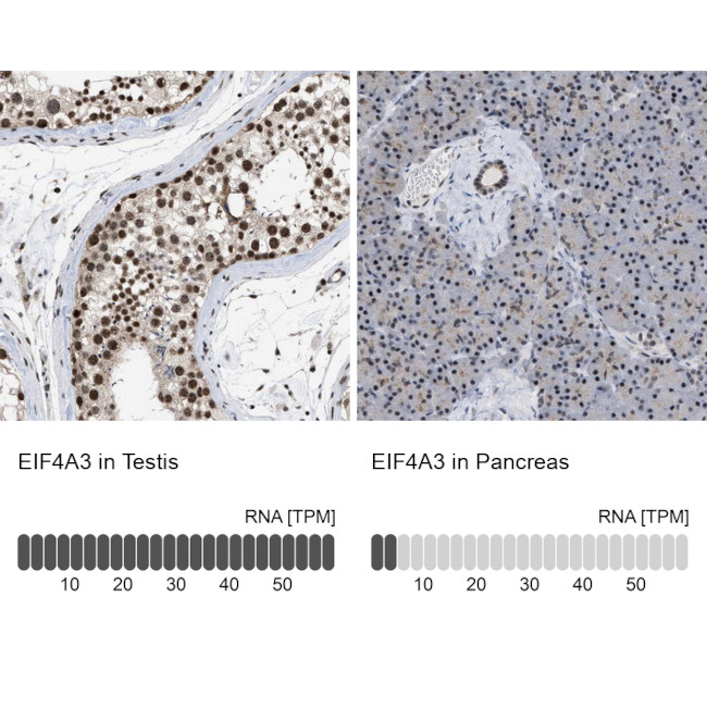 eIF4A3 Antibody in Immunohistochemistry (IHC)