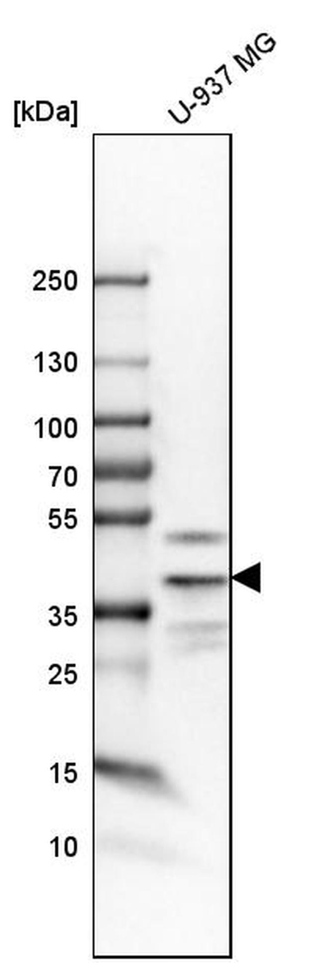 TWISTNB Antibody in Western Blot (WB)