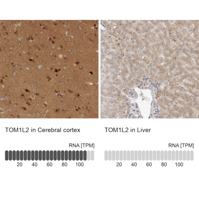 TOM1L2 Antibody in Immunohistochemistry (IHC)