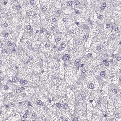 RUNDC3A Antibody in Immunohistochemistry (IHC)