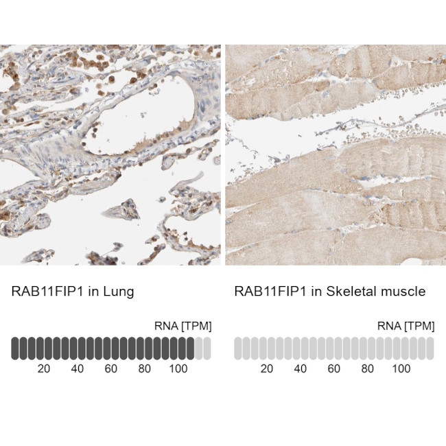 RAB11FIP1 Antibody in Immunohistochemistry (IHC)
