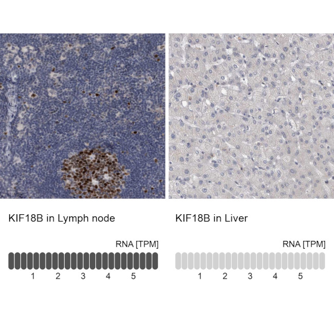 KIF18B Antibody in Immunohistochemistry (IHC)