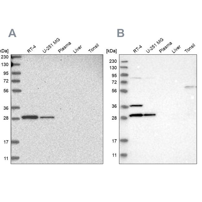 CCDC44 Antibody in Western Blot (WB)