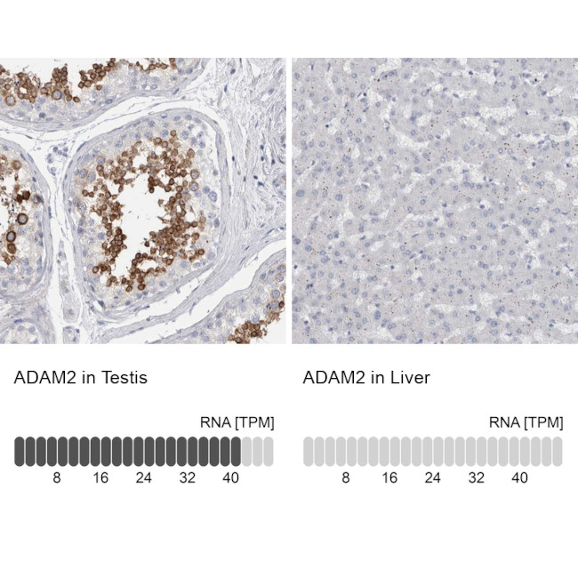ADAM2 Antibody in Immunohistochemistry (IHC)
