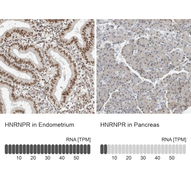 hnRNP R Antibody