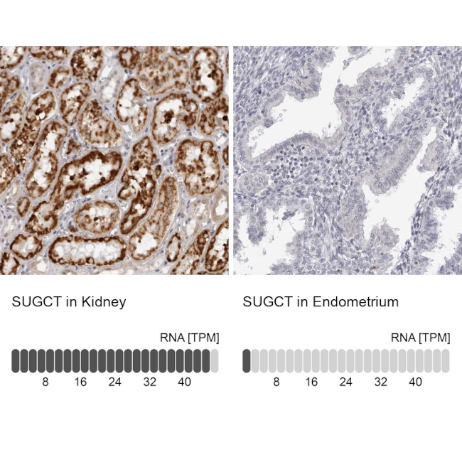 SUGCT Antibody in Immunohistochemistry (IHC)
