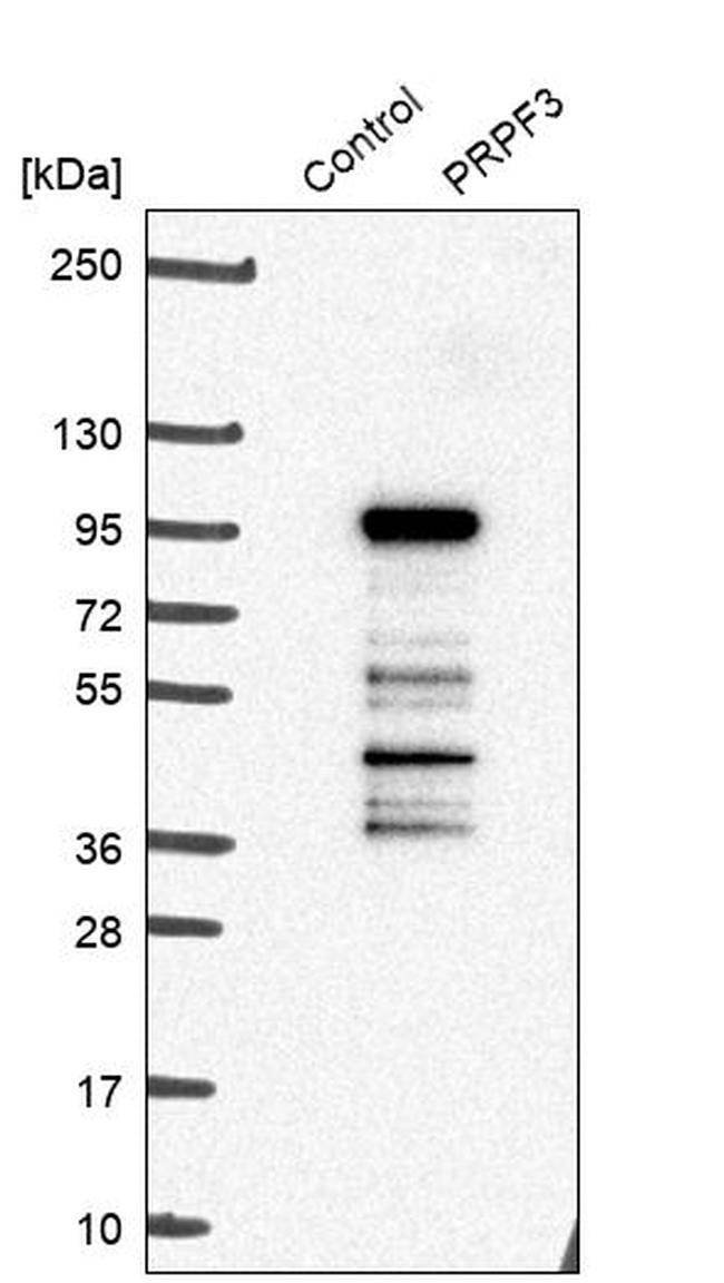 PRPF3 Antibody in Western Blot (WB)