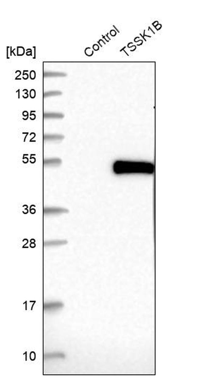 TSSK1 Antibody in Western Blot (WB)