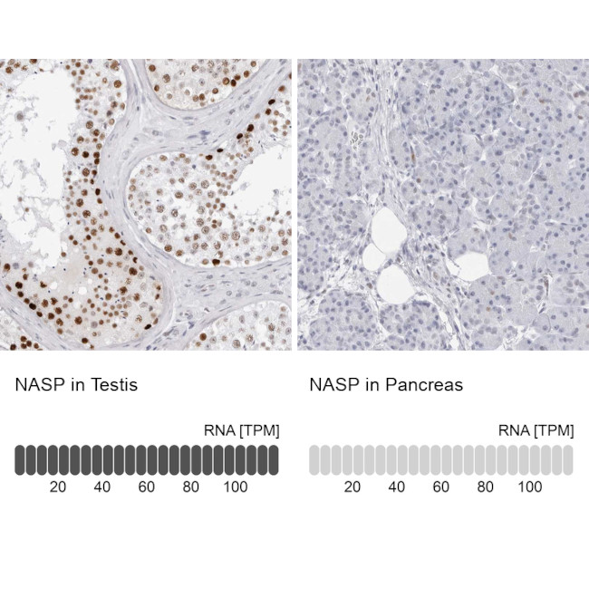NASP Antibody in Immunohistochemistry (IHC)