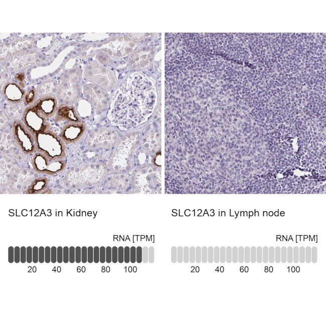 SLC12A3 Antibody