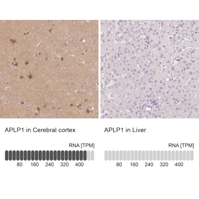 APLP1 Antibody in Immunohistochemistry (IHC)