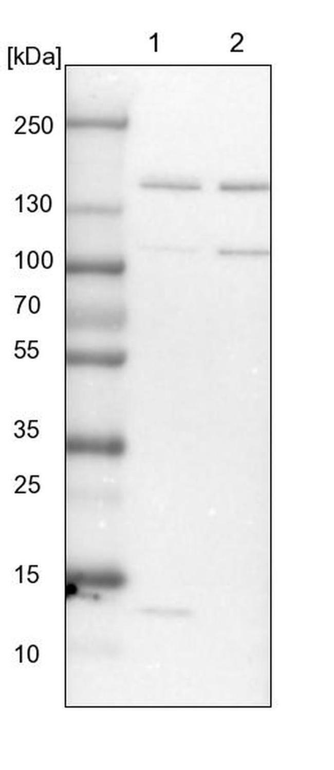 SPT5 Antibody in Western Blot (WB)