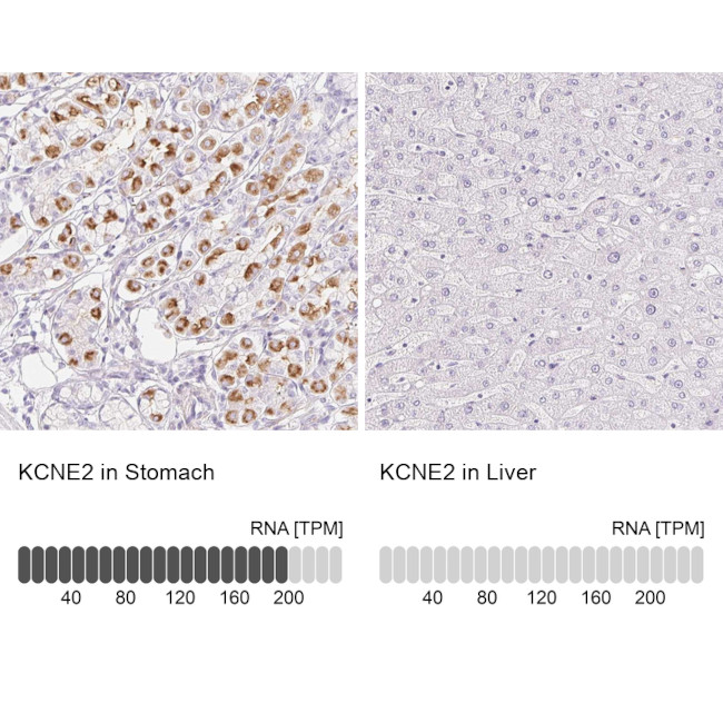 KCNE2 Antibody in Immunohistochemistry (IHC)