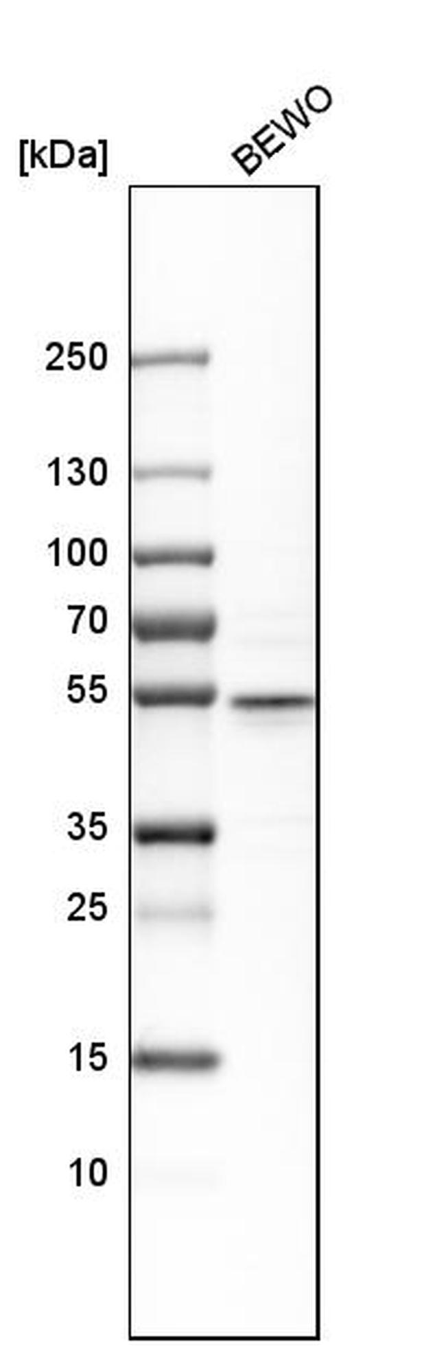 CRISPLD2 Antibody in Western Blot (WB)