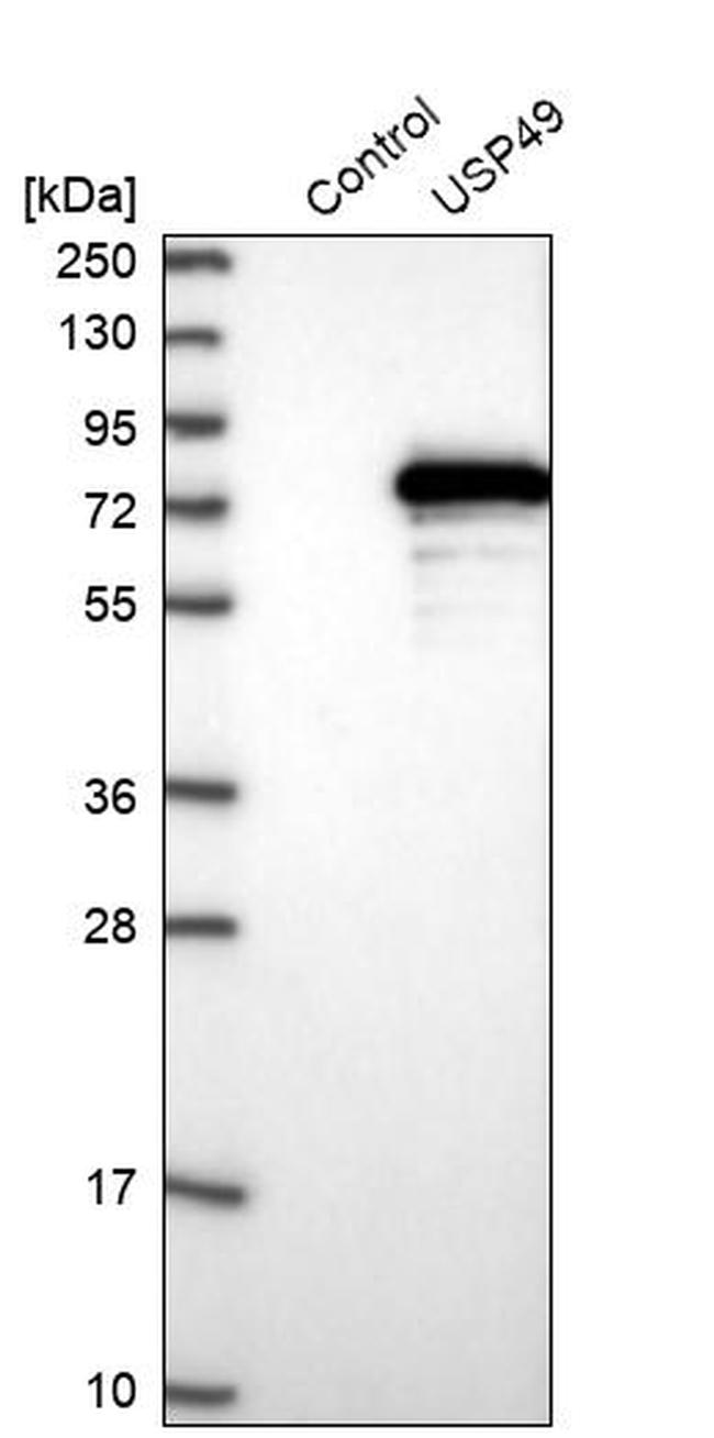 USP49 Antibody in Western Blot (WB)