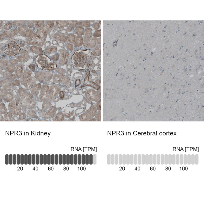 NPR3 Antibody in Immunohistochemistry (IHC)