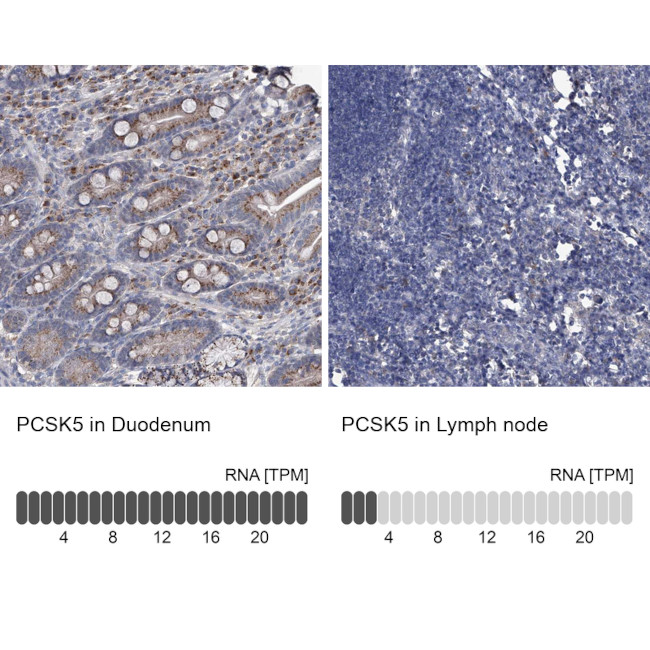 PCSK5 Antibody in Immunohistochemistry (IHC)
